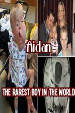 Watch Aidan The Rarest Boy In The World Moviesjoy