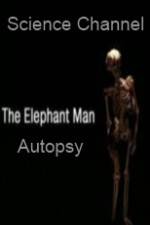 Watch Science Channel Elephant Man Autopsy Moviesjoy