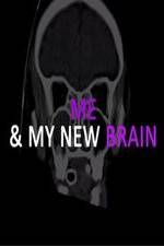 Watch Me & My New Brain Moviesjoy