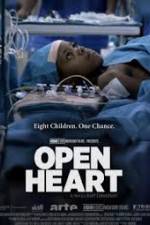 Watch Open Heart Moviesjoy