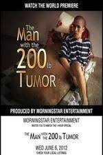 Watch The Man With The 200lb Tumor Moviesjoy
