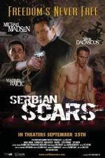 Watch Serbian Scars Moviesjoy
