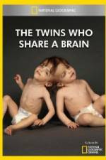 Watch National Geographic The Twins Who Share A Brain Moviesjoy