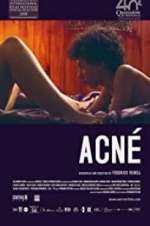 Watch Acné Moviesjoy