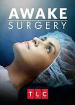 Watch Awake Surgery Moviesjoy